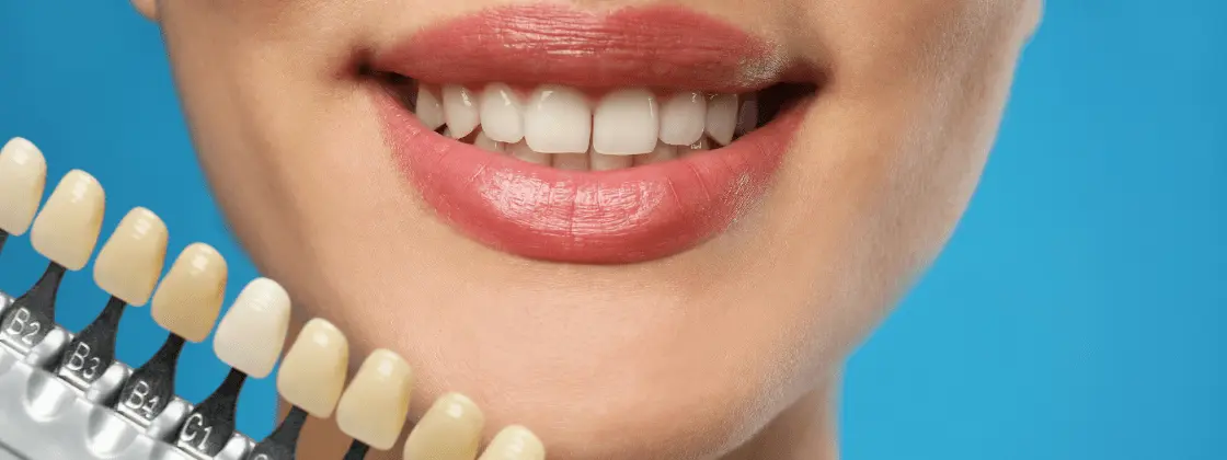 Odontologia-Cosmetica-Mejorando-tu-Sonrisa-y-Aumentando-tu-Confianza