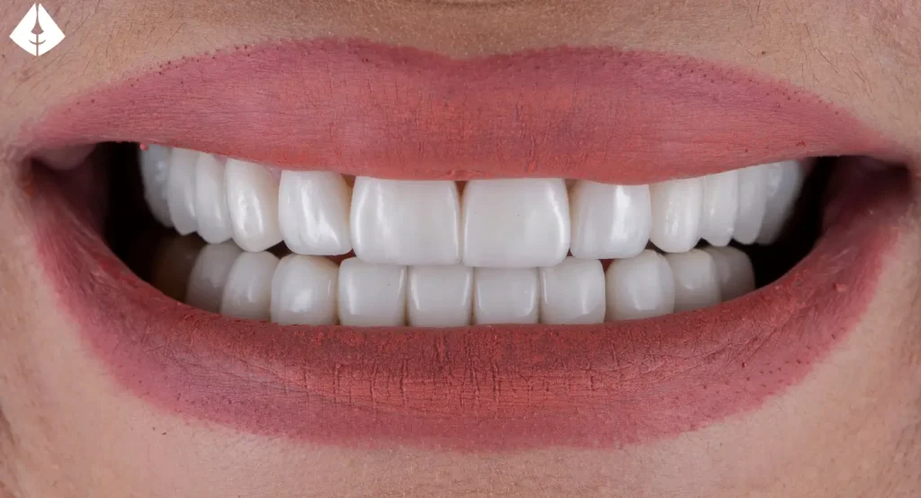 Dé el Primer Paso Hacia una Sonrisa Sin Sensibilidad