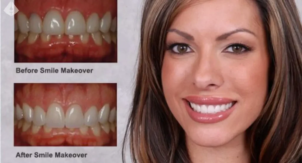 El Proceso Exclusivo de Diseño de Sonrisas: Tecnología y Arte