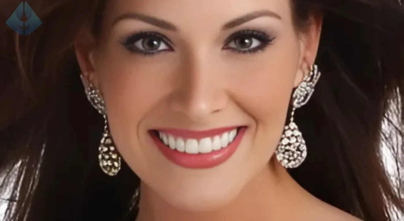 Diseño de Sonrisa sin Brackets NJ Dr. Carranza